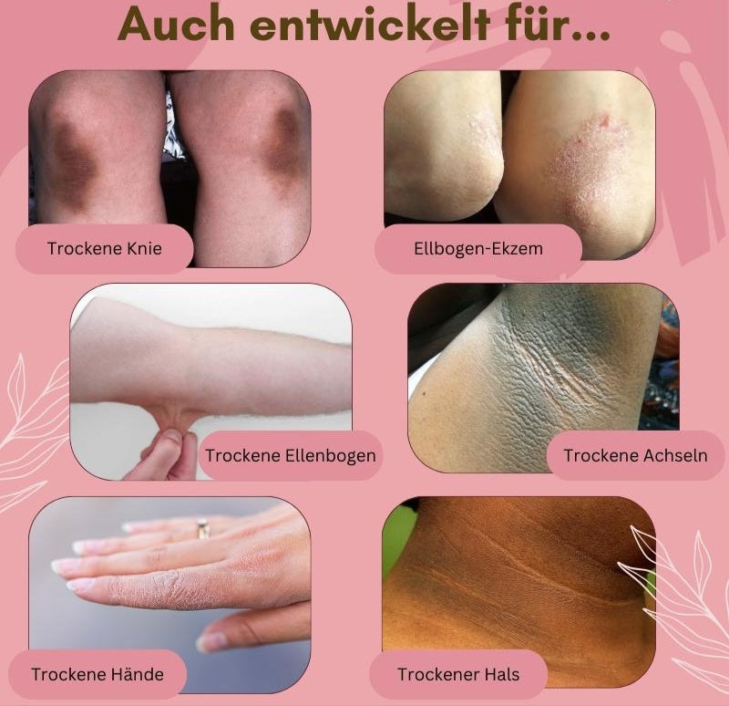 1+1 GRATIS | FungaRelief™ Arnika-Creme — Rissige Haut schnell reparieren