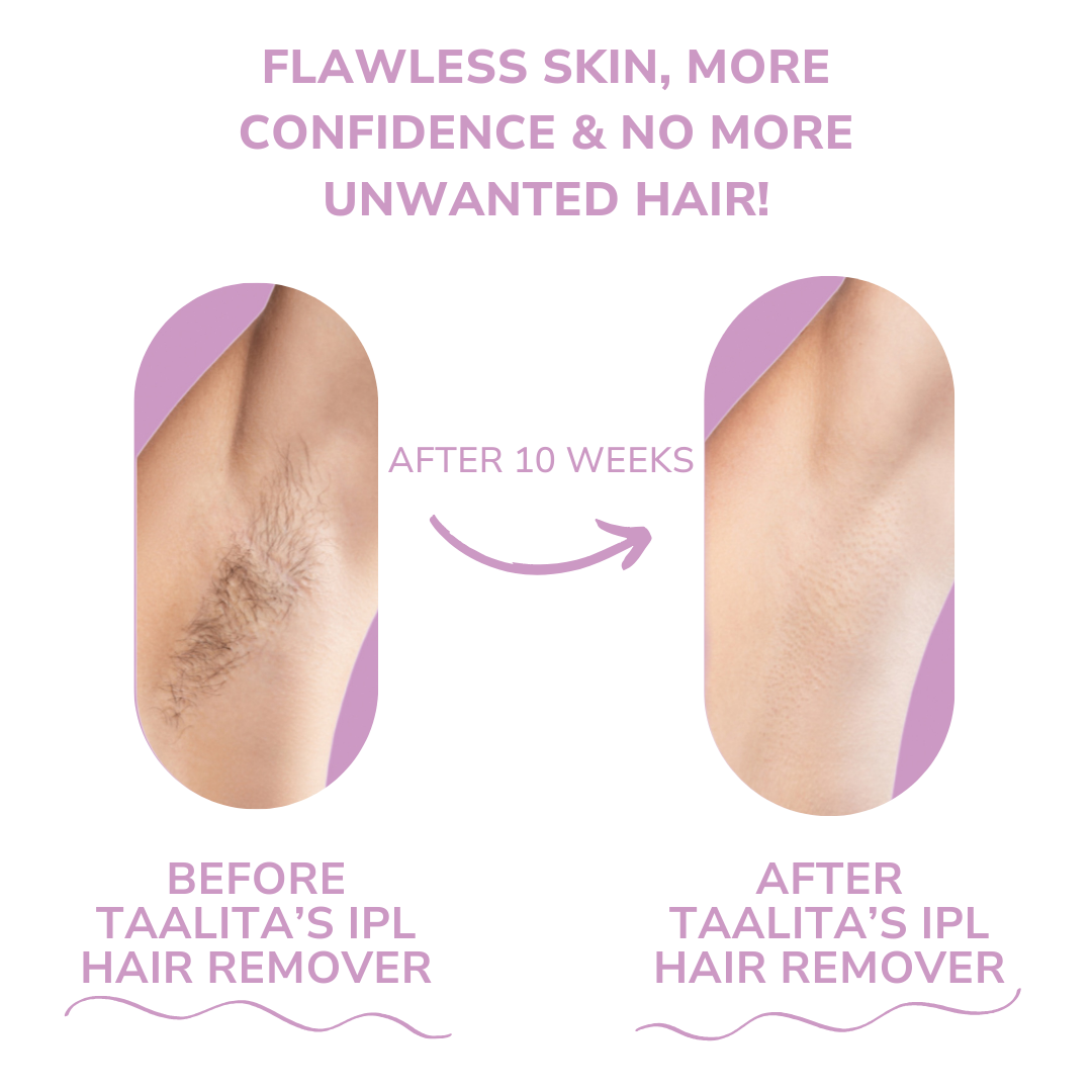 LumaSilk™ – Schmerzfreie seidige Glätte, die Ihr Selbstvertrauen jeden Tag stärkt