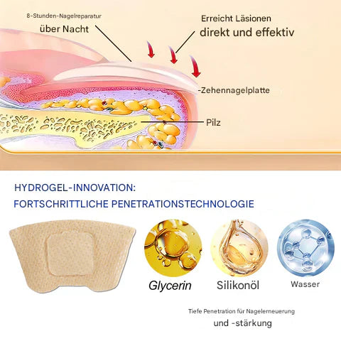 1+1 Gratis | Nailox™ Pflanzliche Formel, die tief eindringt, um Nägel zu heilen und zu erneuern