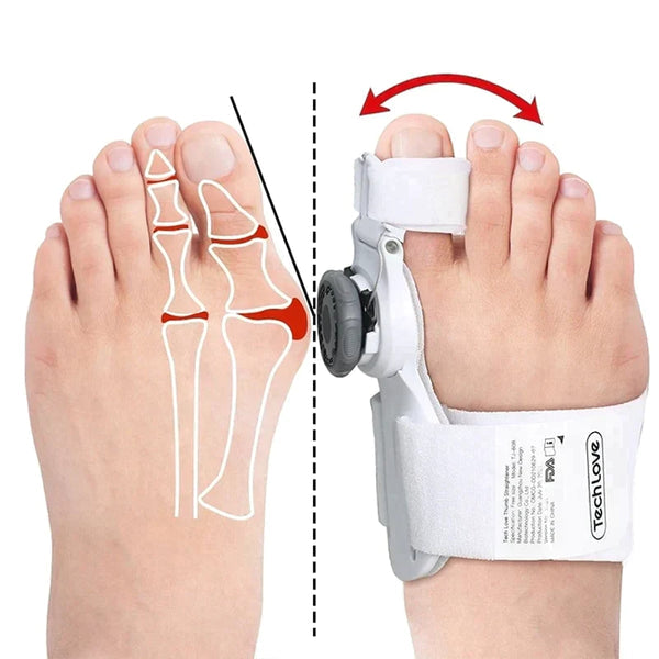 Alignix™ - Universeller Korrektor für Hallux Valgus