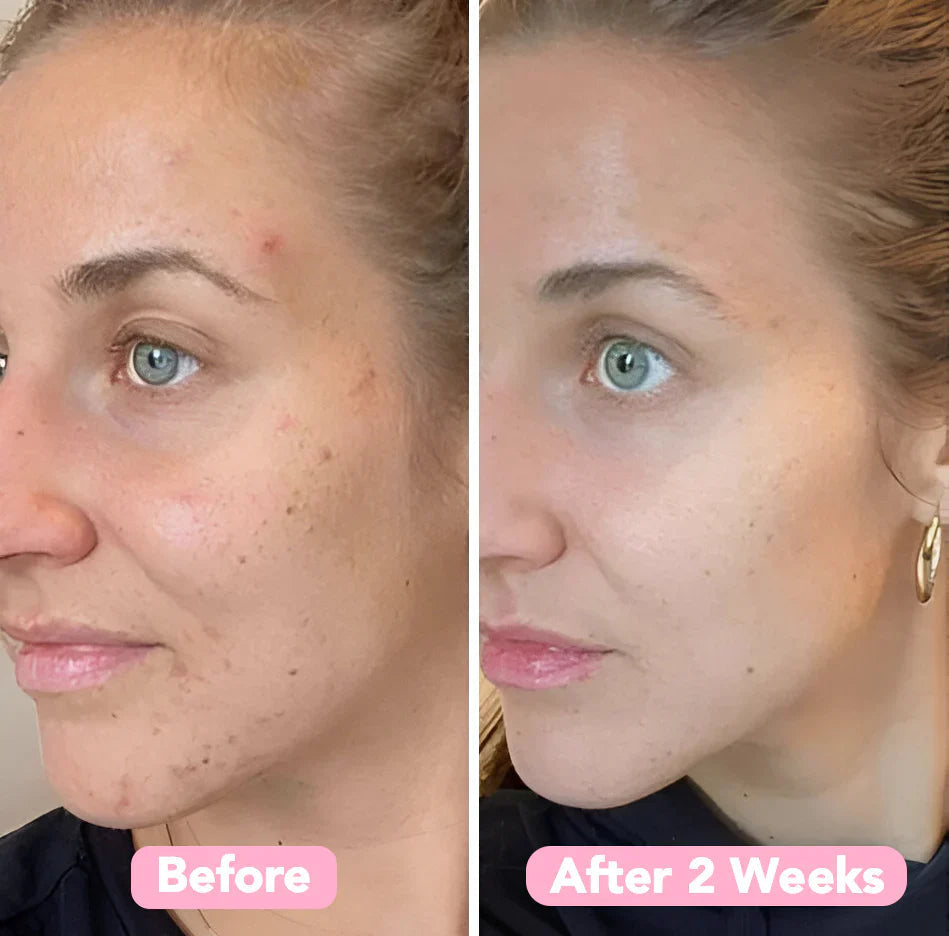 2+2 GRATIS | BrightEase™ Für reinere Haut durch die sanfte tägliche Entfernung abgestorbener Hautzellen