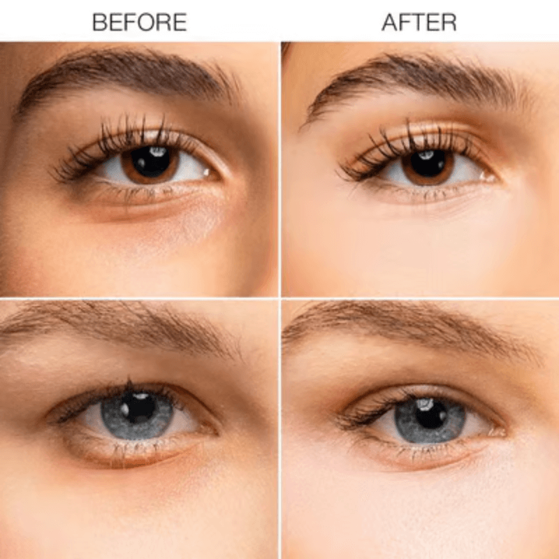 1+1 GRATIS | LuminEye™ Augenringe abdecken & Augenpartie aufhellen