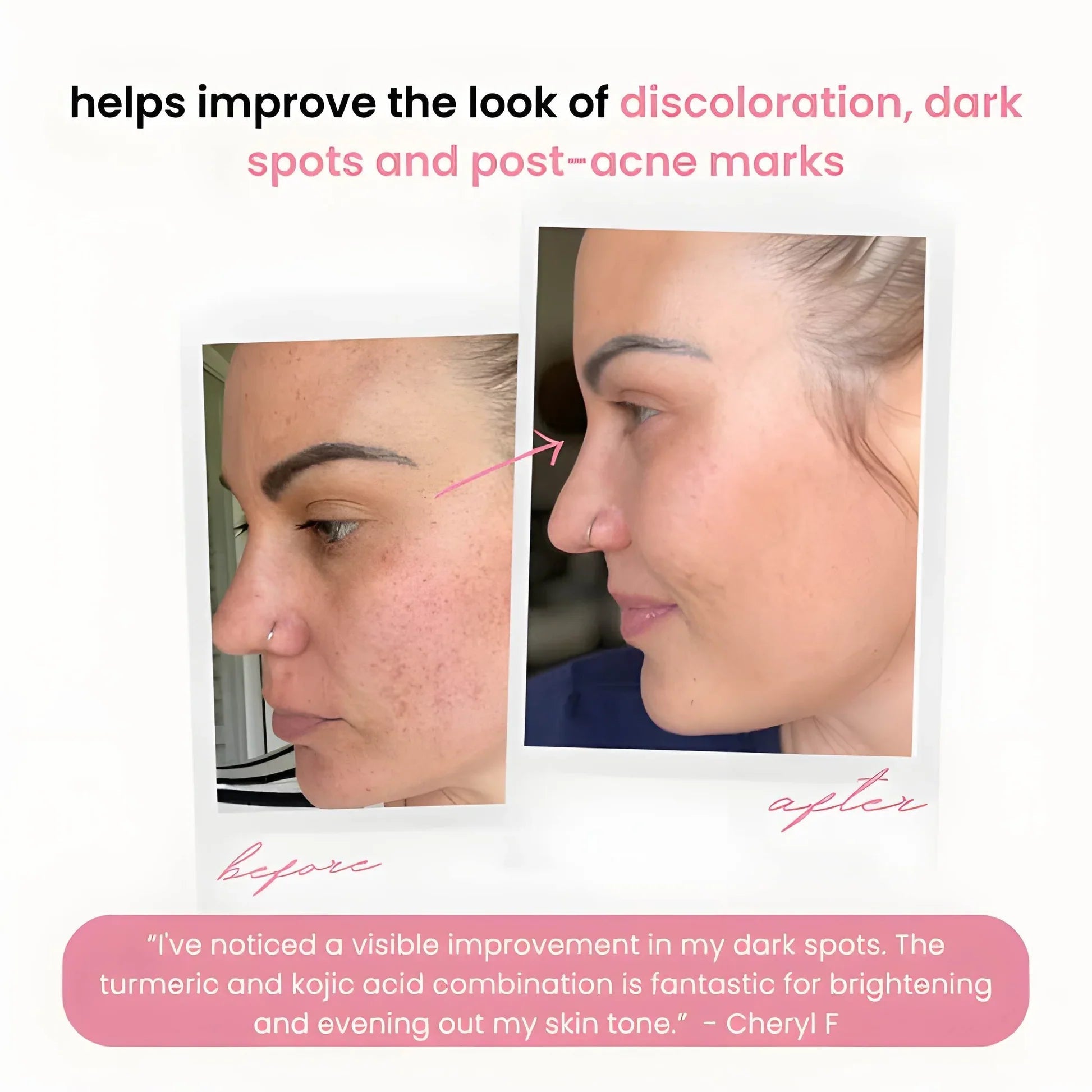 2+2 GRATIS | BrightEase™ Für reinere Haut durch die sanfte tägliche Entfernung abgestorbener Hautzellen