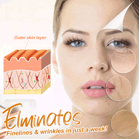 1+1 Gratis | Kollagen Instant Boost™ Beseitigen Sie Fältchen und Furchen in nur einer Woche!