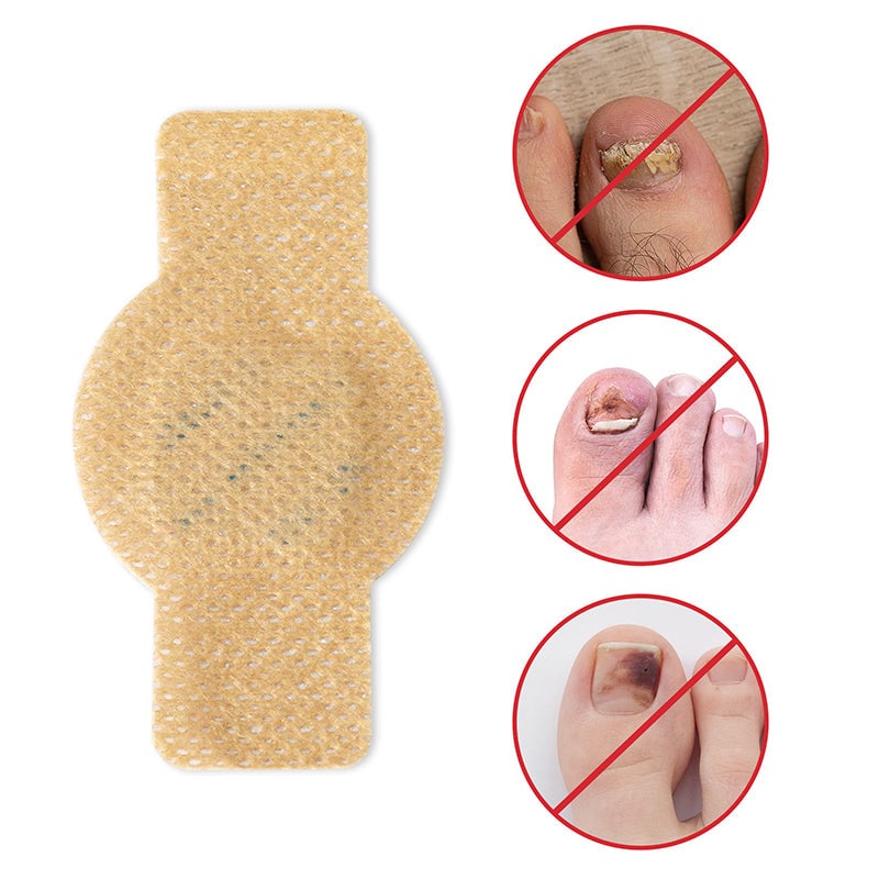 1+1 Gratis | Nailox™ Pflanzliche Formel, die tief eindringt, um Nägel zu heilen und zu erneuern