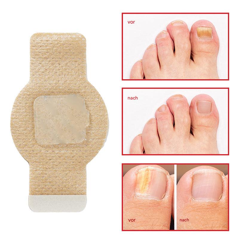 1+1 Gratis | Nailox™ Pflanzliche Formel, die tief eindringt, um Nägel zu heilen und zu erneuern